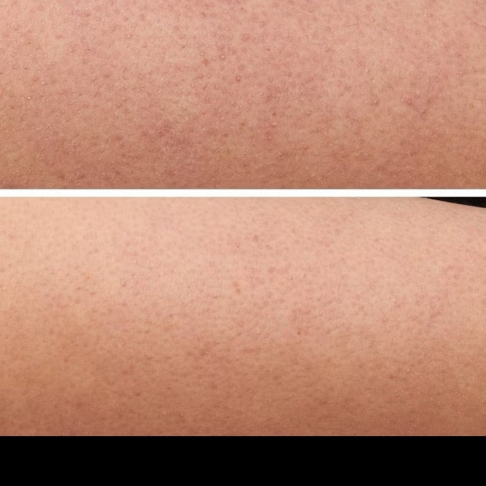 Last One! StriVectin KP Care Body Cream - Picture 5 of 8